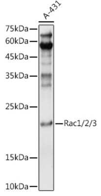 Western Blot: Rac1 AntibodyAzide and BSA Free [NBP2-94917]